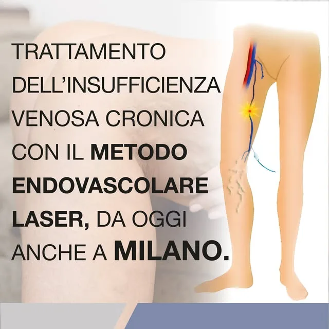Il trattamento endovascolare laser dell'insufficienza venosa cronica, anche a Milano