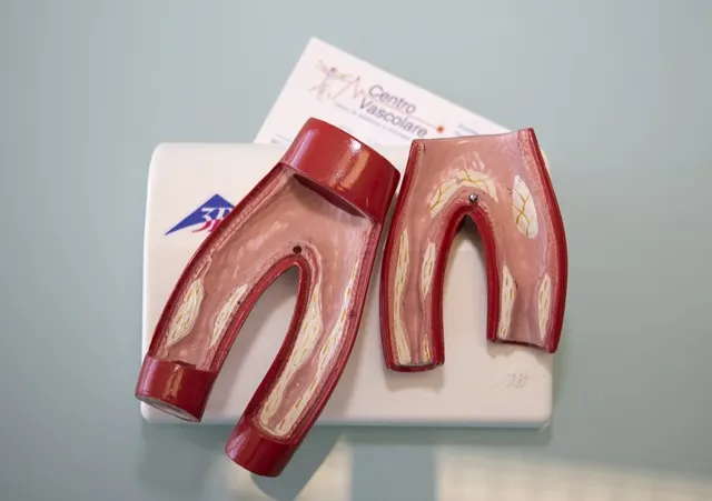 Modello anatomico dei vasi sanguigni sulla scrivania dello studio