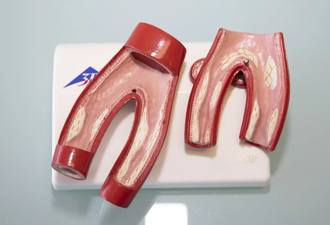 Modello anatomico dei vasi sanguigni appoggiato sulla scrivania dello studio